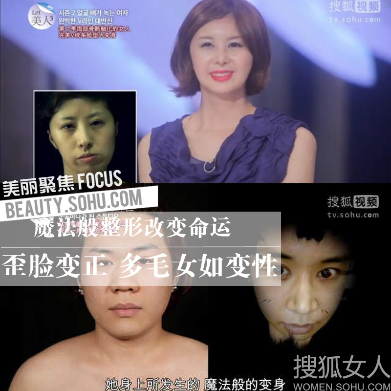 容貌改变命运 <em>多毛</em>女变性般整形-<em>女人</em>频道图片