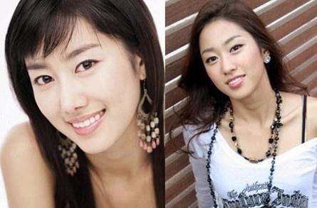 20位韩国女星整容前后对比照